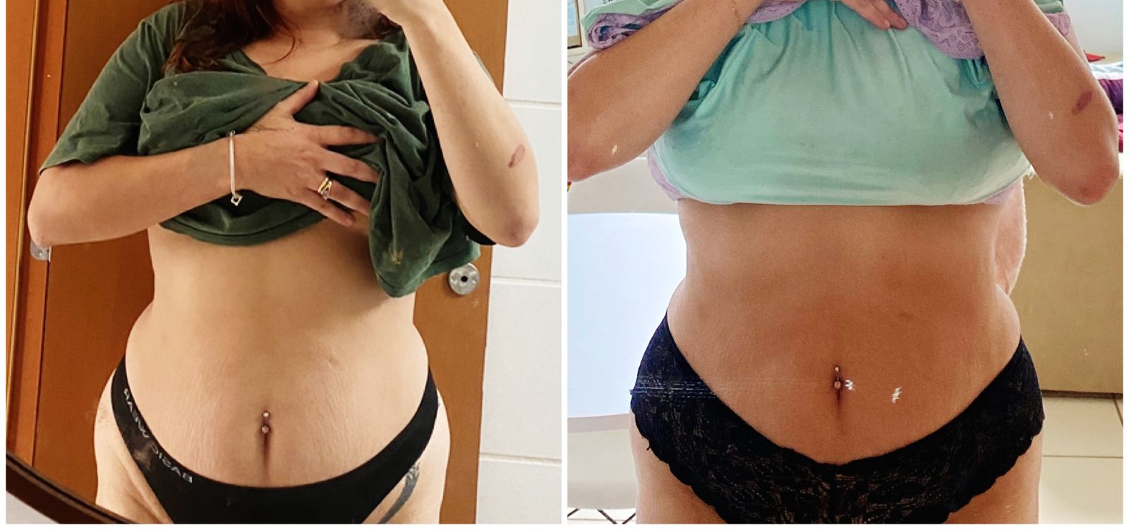 Feedback Lipo Fit