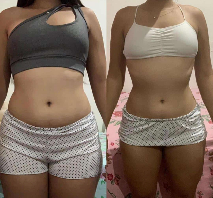 Feedback Lipo Fit